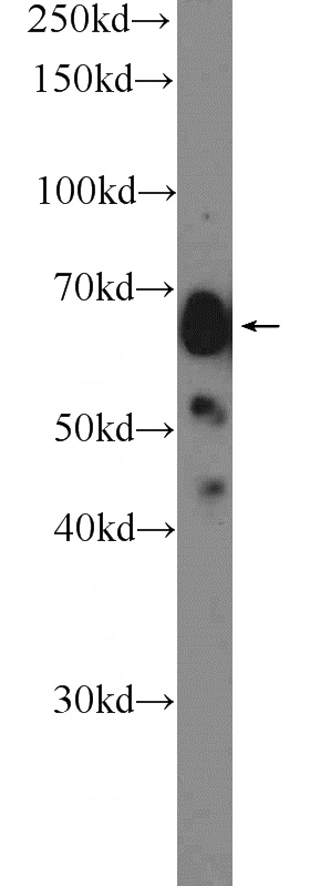 HepG2 cells were subjected to SDS PAGE followed by western blot with Catalog No:111088(GPC3 Antibody) at dilution of 1:600