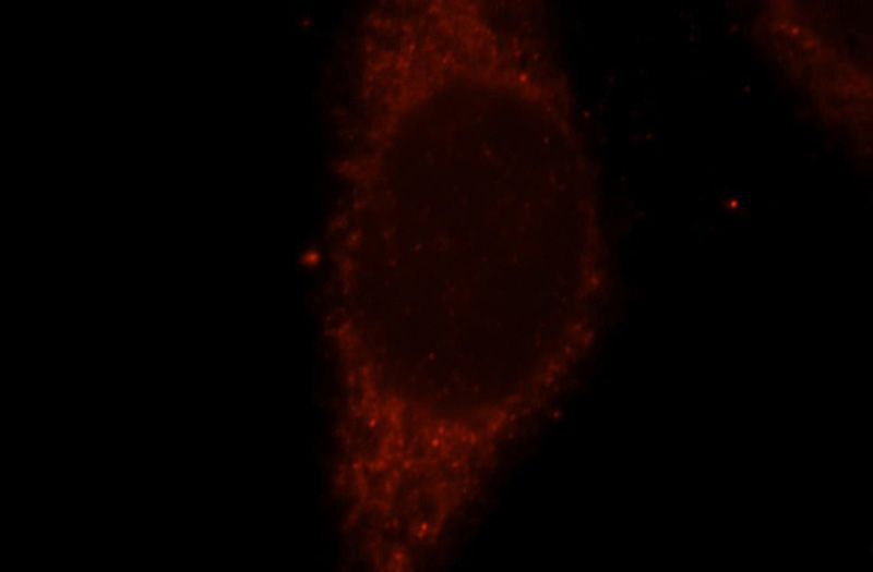 Immunofluorescent analysis of Hela cells, using SUOX antibody Catalog No:115840 at 1:25 dilution and Rhodamine-labeled goat anti-rabbit IgG (red).