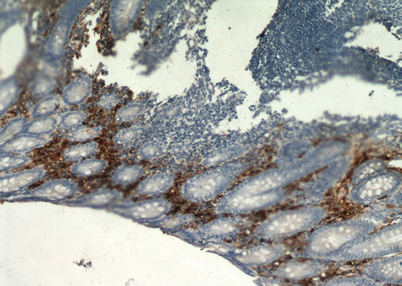 Immunohistochemical of paraffin-embedded human appendix using Catalog No:116217(TPSAB1 antibody) at dilution of 1:100 (under 10x lens)