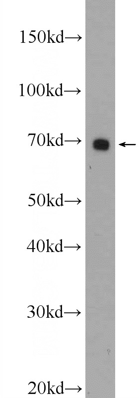 HepG2 cells were subjected to SDS PAGE followed by western blot with Catalog No:116896(YTHDF3 Antibody) at dilution of 1:600