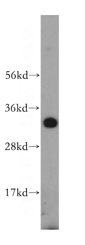HeLa cells were subjected to SDS PAGE followed by western blot with Catalog No:115324(SLC25A15 antibody) at dilution of 1:500