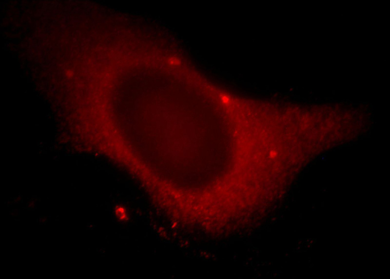 Immunofluorescent analysis of Hela cells, using WDR24 antibody Catalog No:116861 at 1:25 dilution and Rhodamine-labeled goat anti-rabbit IgG (red).
