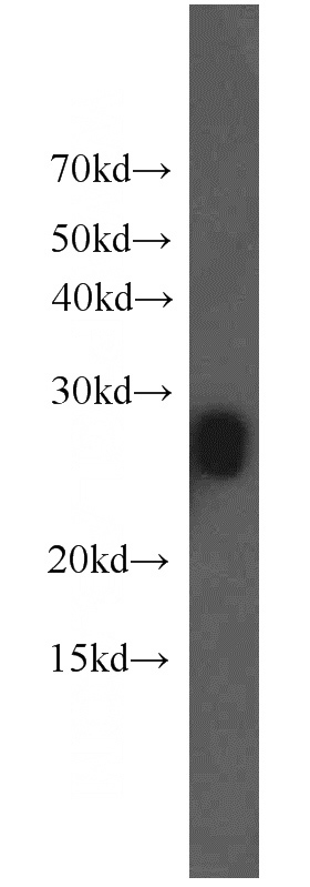 mouse eye tissue were subjected to SDS PAGE followed by western blot with Catalog No:112626(MIP antibody) at dilution of 1:500