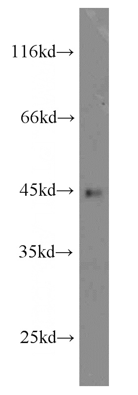 human spleen tissue were subjected to SDS PAGE followed by western blot with Catalog No:113419(Orail-L2 antibody) at dilution of 1:300