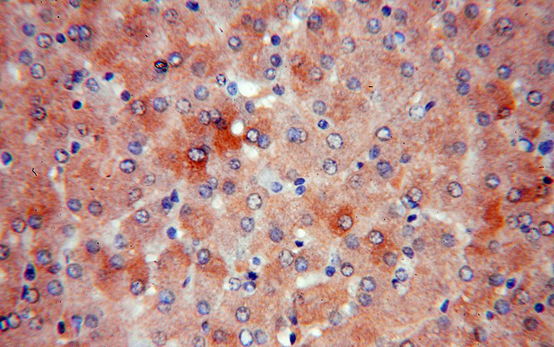 Immunohistochemical of paraffin-embedded human liver using Catalog No:113067(NDUFAF2 antibody) at dilution of 1:100 (under 40x lens)