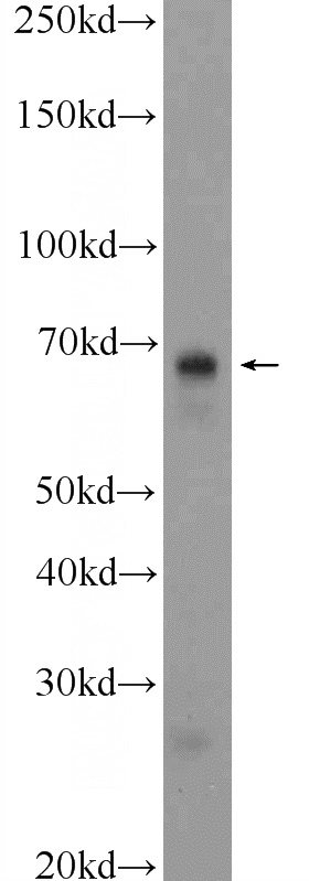 fetal human brain tissue were subjected to SDS PAGE followed by western blot with Catalog No:111371(HDAC10 Antibody) at dilution of 1:600
