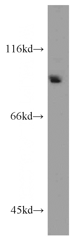 A2780 cells were subjected to SDS PAGE followed by western blot with Catalog No:108419(BAP1 antibody) at dilution of 1:300