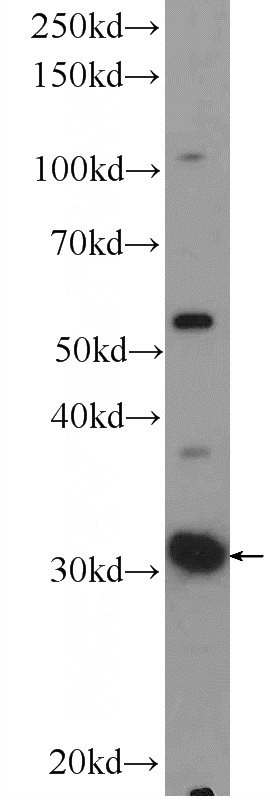 rat liver tissue were subjected to SDS PAGE followed by western blot with Catalog No:108640(C11orf54 Antibody) at dilution of 1:300