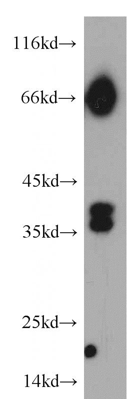 HepG2 cells were subjected to SDS PAGE followed by western blot with Catalog No:114484(RASSF7 antibody) at dilution of 1:200