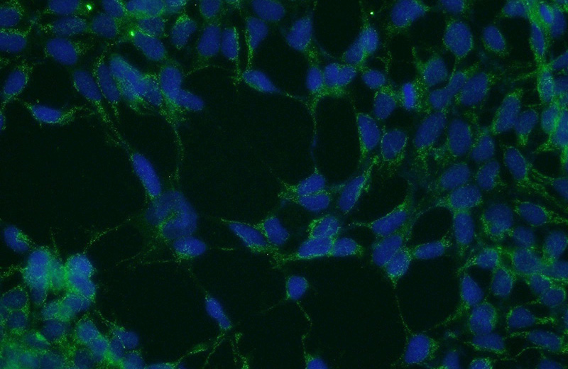 Immunofluorescent analysis of HEK-293 cells using Catalog No:113886(PICK1 Antibody) at dilution of 1:50 and Alexa Fluor 488-congugated AffiniPure Goat Anti-Rabbit IgG(H+L)