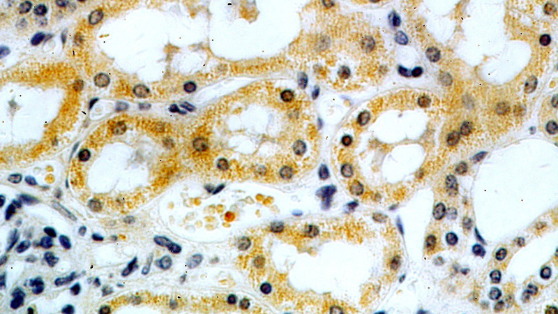 Immunohistochemical of paraffin-embedded human kidney using Catalog No:111645(IKBKG antibody) at dilution of 1:50 (under 40x lens)
