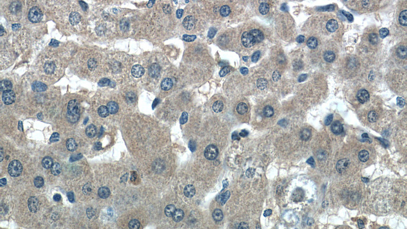 Immunohistochemistry of paraffin-embedded human liver tissue slide using Catalog No:108385(BCHE Antibody) at dilution of 1:50 (under 40x lens)