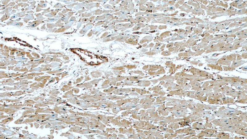 Immunohistochemical of paraffin-embedded human heart using Catalog No:112447(MARCKS antibody) at dilution of 1:50 (under 10x lens)