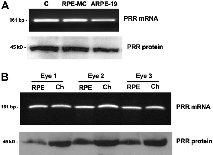 WB result from Oscar Alcazar, et al, (Pro)renin receptor is expressed in human retinal pigment epithelium and participates in extracellular matrix remodeling, Exp Eye Res. 89(5) 638-47 (2009) (PMID:19580809). Eye 45kd.