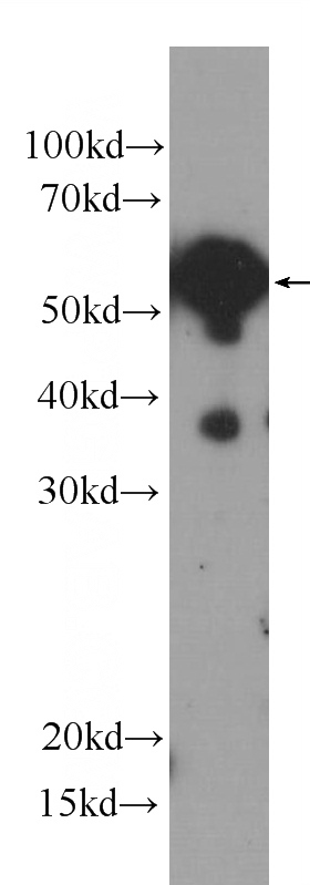 MCF-7 cells were subjected to SDS PAGE followed by western blot with Catalog No:107176(CREST Antibody) at dilution of 1:500