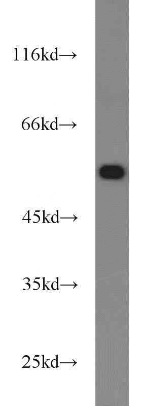 K-562 cells were subjected to SDS PAGE followed by western blot with Catalog No:114008(PLRG1 antibody) at dilution of 1:1000