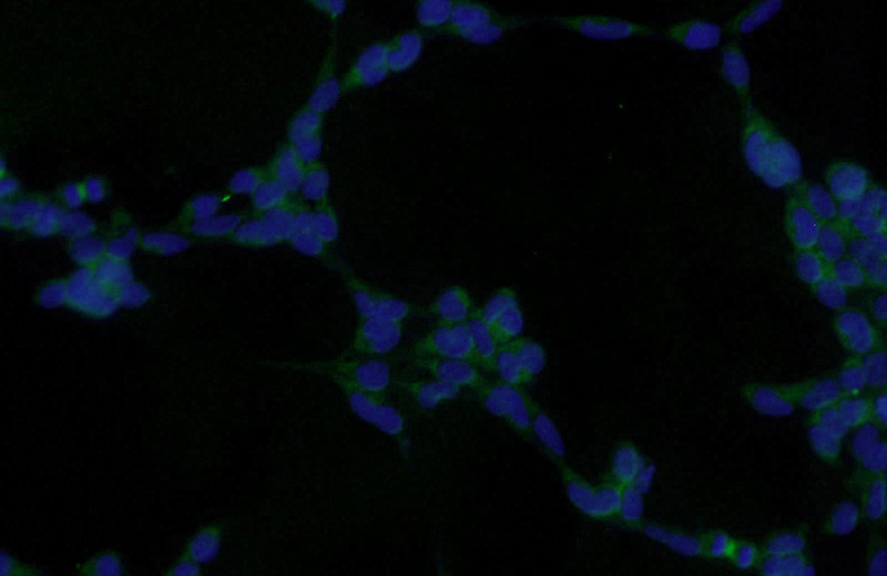 Immunofluorescent analysis of HEK-293 cells using Catalog No:111200(GRB2 Antibody) at dilution of 1:25 and Alexa Fluor 488-congugated AffiniPure Goat Anti-Rabbit IgG(H+L)