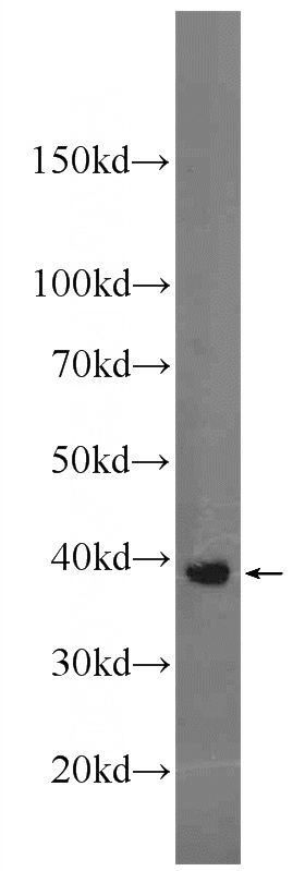 SKOV-3 cells were subjected to SDS PAGE followed by western blot with Catalog No:108732(C4orf49 antibody) at dilution of 1:1000