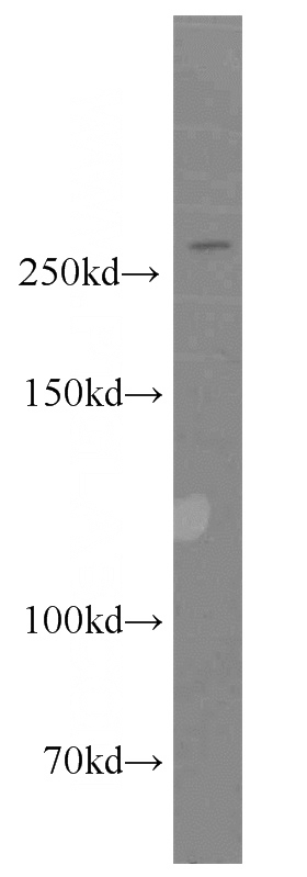 HeLa cells were subjected to SDS PAGE followed by western blot with Catalog No:108325(ATR antibody) at dilution of 1:500