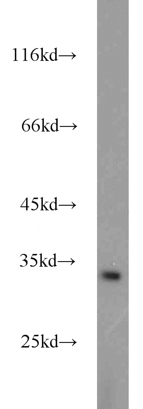 HEK-293 cells were subjected to SDS PAGE followed by western blot with Catalog No:113648(PEF1 antibody) at dilution of 1:1000
