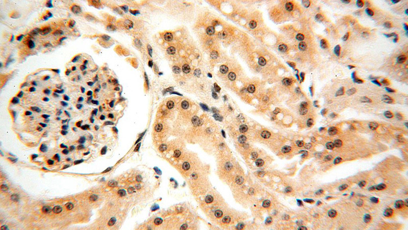 Immunohistochemical of paraffin-embedded human kidney using Catalog No:111377(HDAC4 antibody) at dilution of 1:100 (under 40x lens)