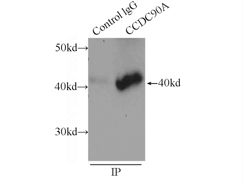 IP Result of anti-CCDC90A (IP:Catalog No:112566, 3ug; Detection:Catalog No:112566 1:300) with HEK-293 cells lysate 920ug.