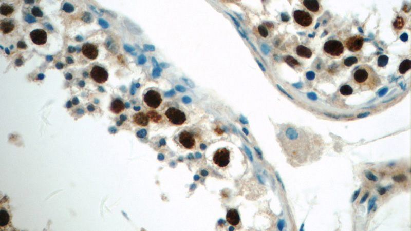 Immunohistochemistry of paraffin-embedded human testis tissue slide using Catalog No:112567(MDC1 Antibody) at dilution of 1:50 (under 40x lens)