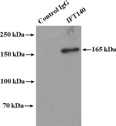 IP Result of anti-IFT140 (IP:Catalog No:111664, 4ug; Detection:Catalog No:111664 1:300) with rat testis tissue lysate 4400ug.