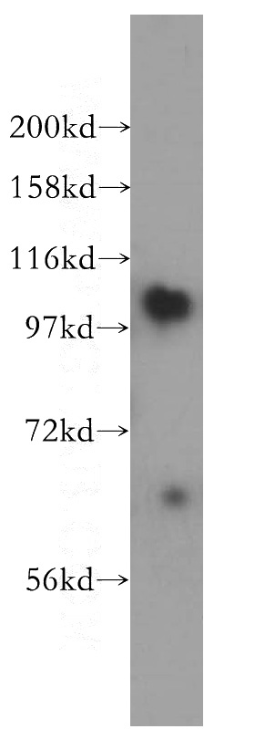 human liver tissue were subjected to SDS PAGE followed by western blot with Catalog No:108002(AMPD2 antibody) at dilution of 1:500