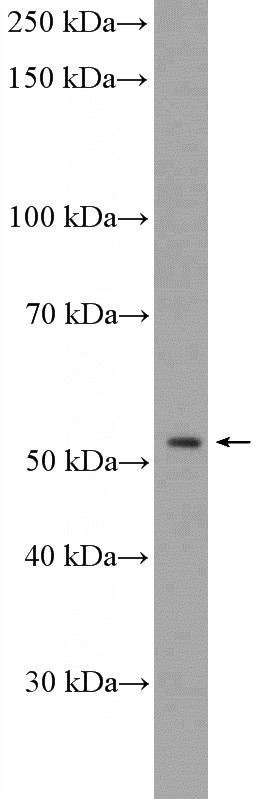 Jurkat cells were subjected to SDS PAGE followed by western blot with Catalog No:115651(SPRYD5 Antibody) at dilution of 1:300