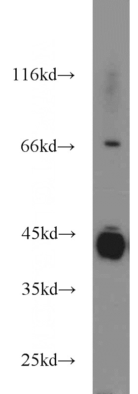 HeLa cells were subjected to SDS PAGE followed by western blot with Catalog No:110991(GNAQ antibody) at dilution of 1:1000