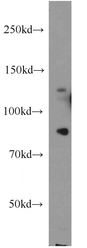 HeLa cells were subjected to SDS PAGE followed by western blot with Catalog No:113502(PALB2 antibody) at dilution of 1:500
