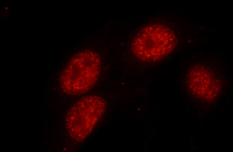 Immunofluorescent analysis of HepG2 cells using Catalog No:116053(THRAP3 Antibody) at dilution of 1:25 and Rhodamine-Goat anti-Rabbit IgG