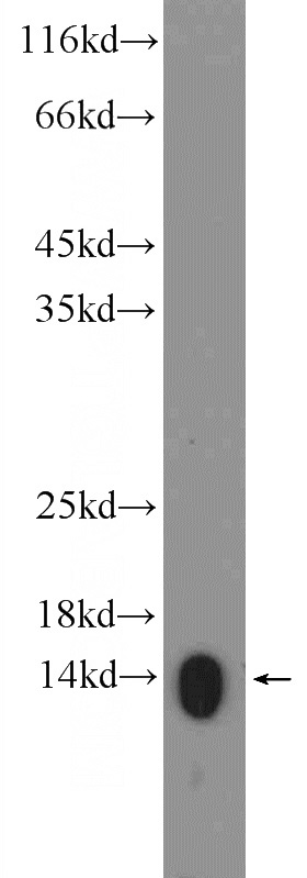 L02 cells were subjected to SDS PAGE followed by western blot with Catalog No:111363(HIST2H2AA4 Antibody) at dilution of 1:600