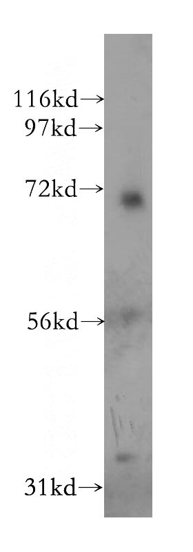 human kidney tissue were subjected to SDS PAGE followed by western blot with Catalog No:114302(PSG1 antibody) at dilution of 1:500