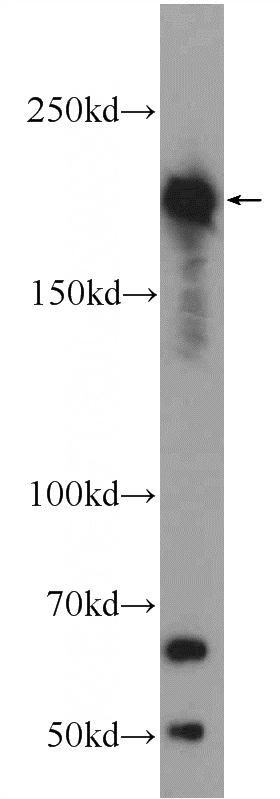 L02 cells were subjected to SDS PAGE followed by western blot with Catalog No:114693(REST Antibody) at dilution of 1:600