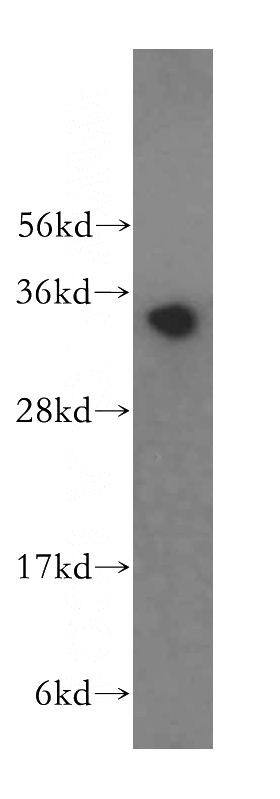 HeLa cells were subjected to SDS PAGE followed by western blot with Catalog No:110537(FBL antibody) at dilution of 1:500