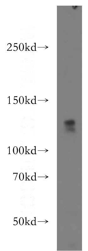 HeLa cells were subjected to SDS PAGE followed by western blot with Catalog No:116813(WDR6 antibody) at dilution of 1:500