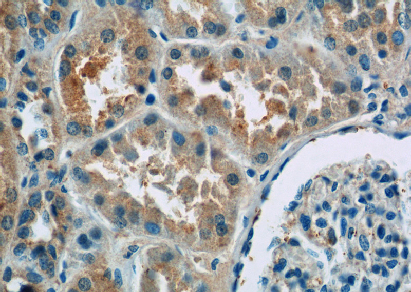 Immunohistochemistry of paraffin-embedded human kidney tissue slide using Catalog No:109252(CENPF Antibody) at dilution of 1:50 (under 40x lens)