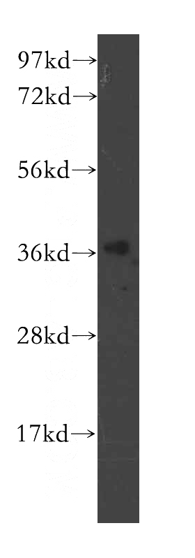 human brain tissue were subjected to SDS PAGE followed by western blot with Catalog No:114051(POLR3F antibody) at dilution of 1:400