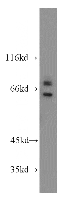 HEK-293 cells were subjected to SDS PAGE followed by western blot with Catalog No:114970(SARS antibody) at dilution of 1:1000
