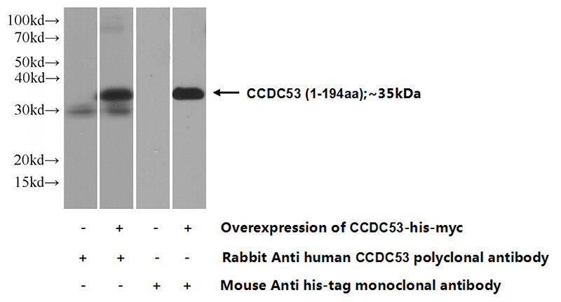 Transfected HEK-293 cells were subjected to SDS PAGE followed by western blot with Catalog No:108979(CCDC53 Antibody) at dilution of 1:1000