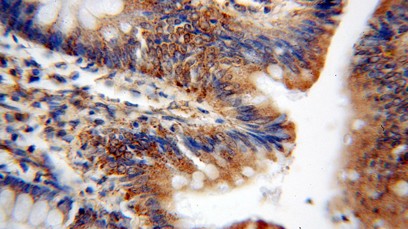 Immunohistochemical of paraffin-embedded human colon using Catalog No:117238(PTK6 antibody) at dilution of 1:100 (under 40x lens)