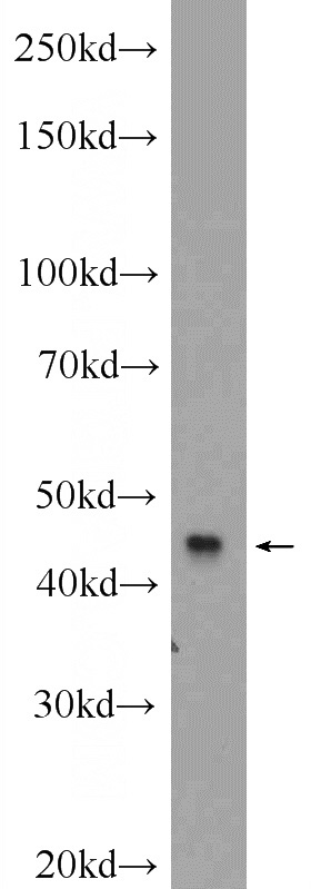 SH-SY5Y cells were subjected to SDS PAGE followed by western blot with Catalog No:112547(MCHR1 Antibody) at dilution of 1:1000