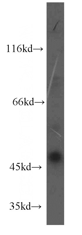 HepG2 cells were subjected to SDS PAGE followed by western blot with Catalog No:115021(SCRN3 antibody) at dilution of 1:500