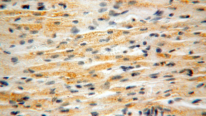 Immunohistochemical of paraffin-embedded human heart using Catalog No:113363(NUDT8 antibody) at dilution of 1:100 (under 40x lens)