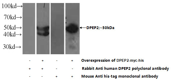 Transfected HEK-293 cells were subjected to SDS PAGE followed by western blot with Catalog No:110063(DPEP2 Antibody) at dilution of 1:1000