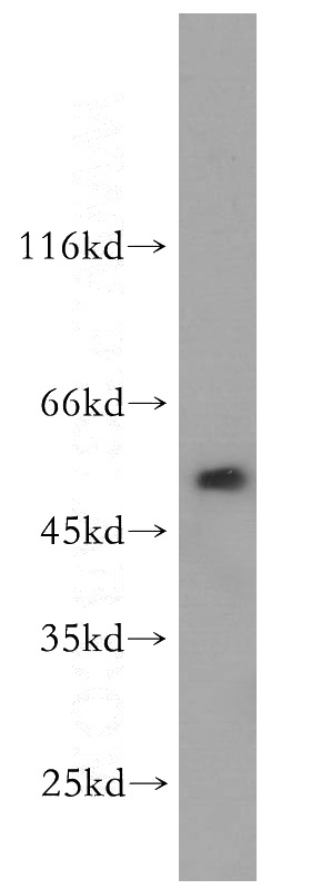 mouse kidney tissue were subjected to SDS PAGE followed by western blot with Catalog No:116972(WSB2 antibody) at dilution of 1:1000