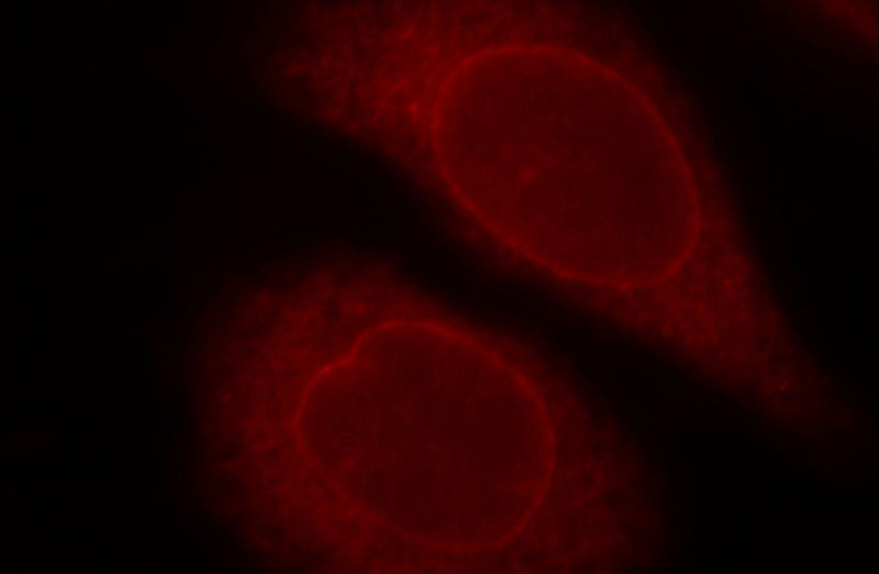Immunofluorescent analysis of Hela cells, using ZC3H4 antibody Catalog No: at 1:25 dilution and Rhodamine-labeled goat anti-rabbit IgG (red).