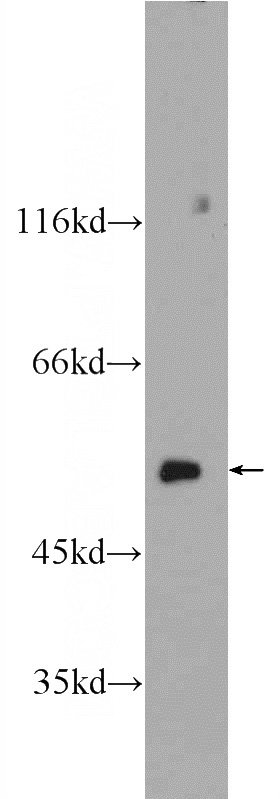 mouse testis tissue were subjected to SDS PAGE followed by western blot with Catalog No:109081(CCT2 Antibody) at dilution of 1:1000